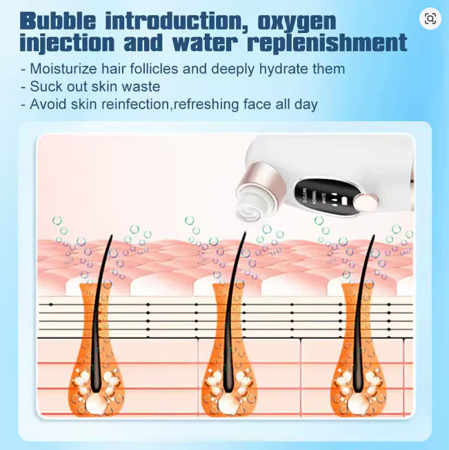 Super Micro Bubble Facial Cleansing Device & Blackhead Remover